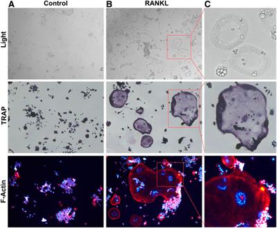 Receptor activator of nuclear factor-κB ligand-mediated osteoclastogenesis signaling pathway and related therapeutic natural compounds